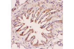 Anti-MyD88 Picoband antibody,  IHC(P): Rat Lung Tissue