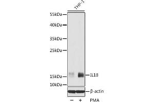 Western blot analysis of extracts of THP-1 cells using IL1 beta Polyclonal Antibody at dilution of 1:1000. (IL-1 beta anticorps)