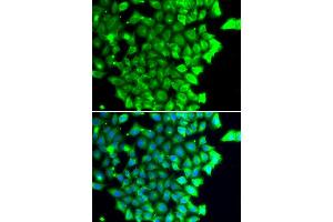 Immunofluorescence analysis of MCF7 cell using TRIAP1 antibody. (TRIAP1 anticorps)