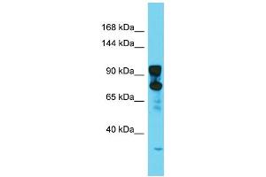 Host: Rabbit  Target Name: Dnm2  Sample Tissue: Rat Testis lysates  Antibody Dilution: 1. (DNM2 anticorps  (N-Term))