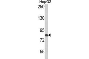 Western Blotting (WB) image for anti-Endothelin-Converting Enzyme 1 (ECE1) antibody (ABIN3002835) (ECE1 anticorps)