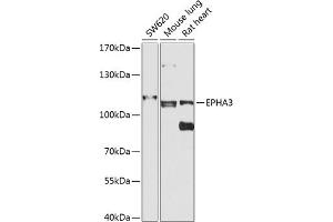 Western blot analysis of extracts of various cell lines, using EPH antibody (ABIN6131627, ABIN6140213, ABIN6140214 and ABIN6224468) at 1:1000 dilution. (EPH Receptor A3 anticorps  (AA 400-545))