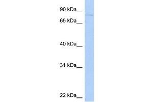 WB Suggested Anti-KIF2C Antibody Titration:  0. (KIF2C anticorps  (N-Term))