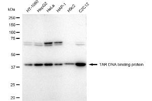 Western blotting analysis using TAR DNA binding protein antibody (ABIN7800511).