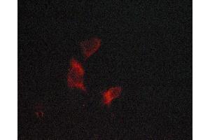 ABIN6269253 staining lovo cells by ICC/IF.