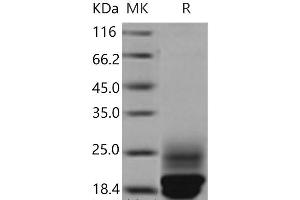 Western Blotting (WB) image for Cystatin C (CST3) protein (His tag) (ABIN7195330) (CST3 Protein (His tag))