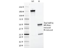 SDS-PAGE Analysis of Purified Calnexin Mouse Monoclonal Antibody ABIN6383801.