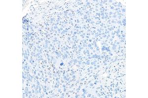 Immunohistochemistry (IHC) image for anti-Spleen Focus Forming Virus (SFFV) Proviral Integration Oncogene Spi1 (SPI1) (AA 220-270) antibody (ABIN7455166)