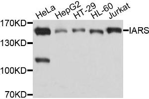 Western blot analysis of extracts of various cells, using IARS antibody. (IARS anticorps)