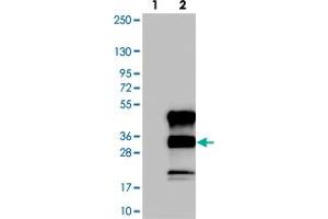 Western blot analysis of Lane 1: Negative control (vector only transfected HEK293T lysate). (C12orf43 anticorps)