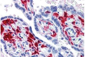 Placenta, Human: Formalin-Fixed, Paraffin-Embedded (FFPE) (DDX58 anticorps)