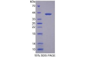 SDS-PAGE analysis of Mouse MYH1 Protein. (MYH1 Protéine)