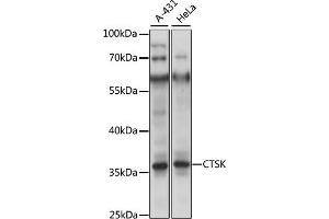 Western blot analysis of extracts of U-87MG cells, using CTSK antibody (ABIN6127669, ABIN6139234 and ABIN7101787) at 1:400 dilution.