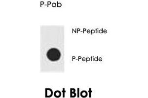 Dot blot analysis of AKT1 (phospho S129) polyclonal antibody  on nitrocellulose membrane. (AKT1 anticorps  (pSer129))