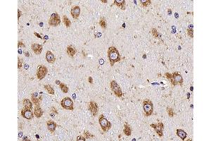 Immunohistochemistry analysis of parafffin-embedded mouse brain using NTS Polyclonal Antibody at dilution of 1:300. (Neurotensin anticorps)
