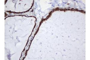 Image no. 15 for anti-SERPINE1 mRNA Binding Protein 1 (SERBP1) (AA 1-262) antibody (ABIN1490675)