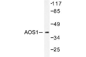 Image no. 1 for anti-SUMO1 Activating Enzyme Subunit 1 (SAE1) antibody (ABIN271943) (SAE1 anticorps)