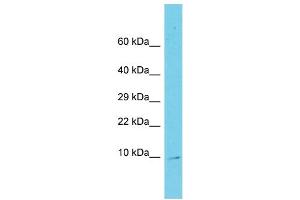 Host: Rabbit Target Name: C11orf75 Sample Type: Fetal Liver lysates Antibody Dilution: 1. (SMCO4 anticorps  (N-Term))