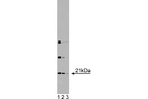 Western Blotting (WB) image for anti-Dihydrofolate Reductase (DHFR) (AA 1-186) antibody (ABIN968119) (Dihydrofolate Reductase anticorps  (AA 1-186))
