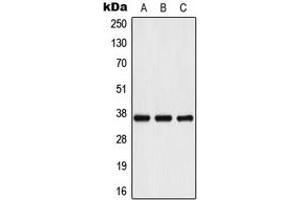 Western blot analysis of IL-10 expression in Romas (A), HeLa (B), mouse liver (C) whole cell lysates. (IL-10 anticorps  (Center))