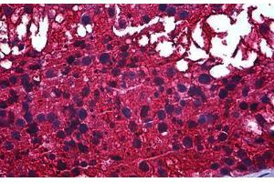 Human Testis: Formalin-Fixed, Paraffin-Embedded (FFPE) (CAPZB anticorps  (AA 192-272))