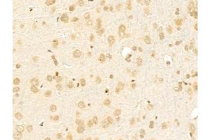ABIN6256948 and ABIN6275299 at 1/100 staining Rat brain tissue by IHC-P. (NBPF1,9,10,12,14,15,16,20 (C-Term) anticorps)