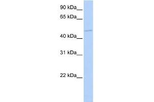 WB Suggested Anti-TGIF1 Antibody Titration:  0.