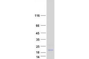 Validation with Western Blot