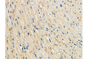 Phospho-Mitofusin 2 (Ser442) Antibody at 1/100 staining Rat heart tissue by IHC-P. (MFN2 anticorps  (pSer442))