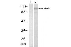 Western blot analysis of extracts from SW626 cell usingα-catenin (Ab-177) Antibody (E021521). (CTNNA1 anticorps)