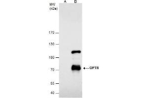 IP Image Optineurin antibody immunoprecipitates Optineurin protein in IP experiments. (OPTN anticorps)