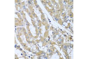 Immunohistochemistry of paraffin-embedded human gastric using STX7 antibody at dilution of 1:100 (x40 lens). (Syntaxin 7 anticorps)