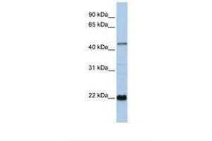 Image no. 1 for anti-Zinc Finger Protein 581 (ZNF581) (AA 72-121) antibody (ABIN6737781) (ZNF581 anticorps  (AA 72-121))