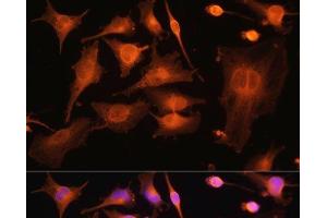 Immunofluorescence analysis of U-251MG cells using TUBB3 Polyclonal Antibody at dilution of 1:100. (TUBB3 anticorps)