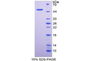 SDS-PAGE (SDS) image for delta-Like 1 Homolog (Drosophila) (DLK1) (AA 24-175) protein (His tag,GST tag) (ABIN1981230) (DLK1 Protein (AA 24-175) (His tag,GST tag))