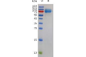 Mouse R Protein, His Tag on SDS-PAGE under reducing condition.