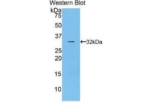 Detection of Recombinant CD2AP, Rat using Polyclonal Antibody to CD2 Associated Protein (CD2AP) (CD2AP anticorps  (AA 368-623))