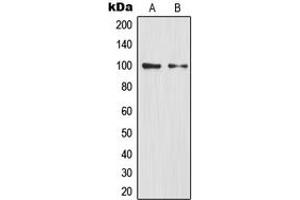 Western blot analysis of NF-kappaB p100 expression in HEK293T (A), mouse liver (B) whole cell lysates. (NFKB2 anticorps  (C-Term))