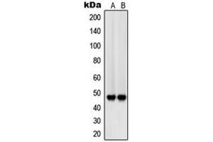 Western blot analysis of CD172b expression in A375 (A), A549 (B) whole cell lysates. (SIRPB1 anticorps  (Center))