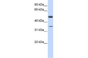 WB Suggested Anti-ZNF223 Antibody Titration:  0. (ZNF223 anticorps  (Middle Region))