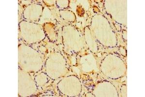 Immunohistochemistry of paraffin-embedded human thyroid tissue using ABIN7154596 at dilution of 1:100 (RIT1 anticorps  (AA 1-219))