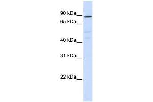 ATP6V0A2 antibody used at 1 ug/ml to detect target protein.