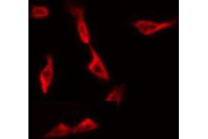 ABIN6268859 staining Hela by IF/ICC.