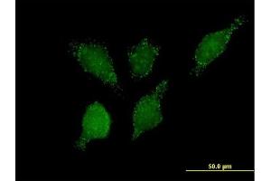 Immunofluorescence of purified MaxPab antibody to PHYH2 on HeLa cell. (HACL1 anticorps  (AA 1-578))