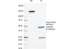 SDS-PAGE Analysis of Purified, BSA-Free c-Myc Antibody (clone 9E10.