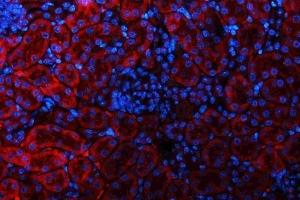 IF analysis of GLS using anti-GLS antibody (ABIN7601603). (Glutaminase anticorps  (AA 396-654))