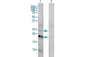 Western Blot analysis of CLDN1 expression in transfected 293T cell line by CLDN1 monoclonal antibody (M01), clone 1C5-D9.