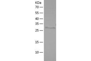 Galectin 3 (LGALS3) (AA 1-264) protein (His tag)