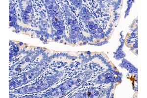 ABIN7094537 and ABIN7098586 at 1/100 staining Rat colorectal tissue by IHC-P.