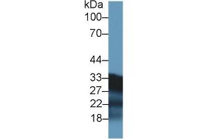 Detection of SDHB in Mouse Kidney lysate using Polyclonal Antibody to Succinate Dehydrogenase Complex Subunit B (SDHB)